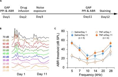 Diffusible Tumor Necrosis Factor-Alpha (TNF-α) Promotes Noise-Induced Parvalbumin-Positive (PV+) Neuron Loss and Auditory Processing Impairments